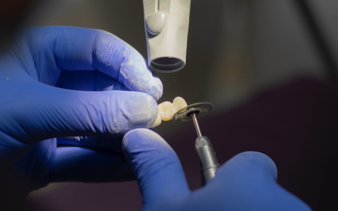 Ścieranie zębów – co na to wpływa i jak temu zapobiec?