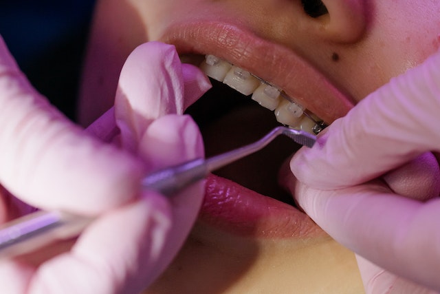 kontrola aparatu ortodontycznego